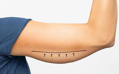 علت-شل-شدن-پوست